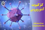 کنژکتیویت آدنوویروس (Adenovirus Conjunctivitis) چیست؟